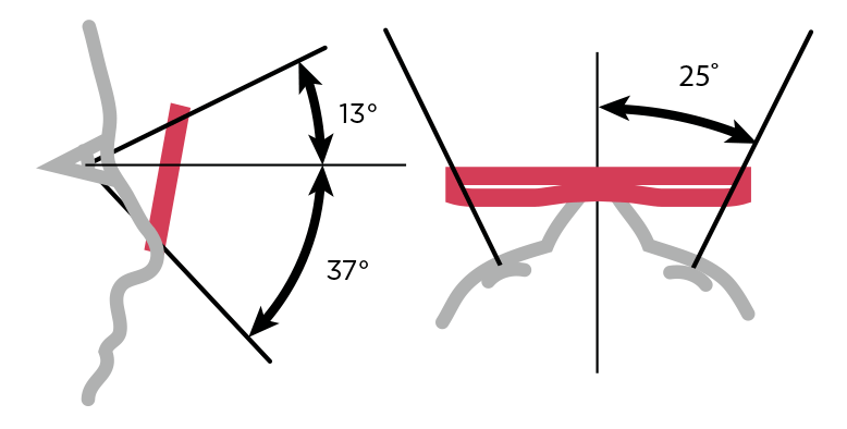 Weldcap_datasheet_3.png Weldcap_datasheet_3.png